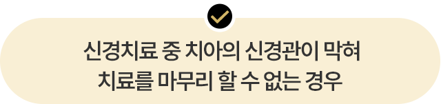 신경치료 중 치아의 신경관이 막혀 치료를 마무리 하 수 없는 경우