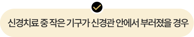 신경치료 중 작은 기구가 신경관 안에서 부러졌을 경우