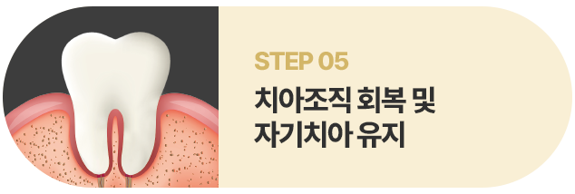 치아조직 회복 및 자기치아 유지