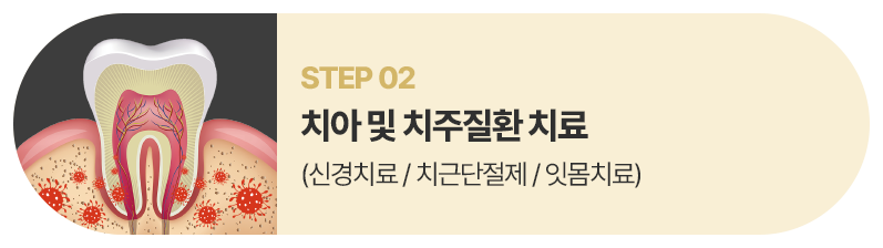 치아 및 치주질환 치료