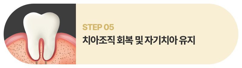 치아조직 회복 및 자기치아 유지