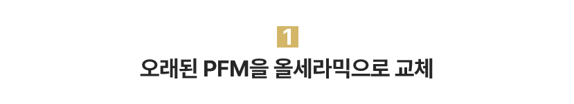 1.오래된 PFM을 올세라믹으로 교체