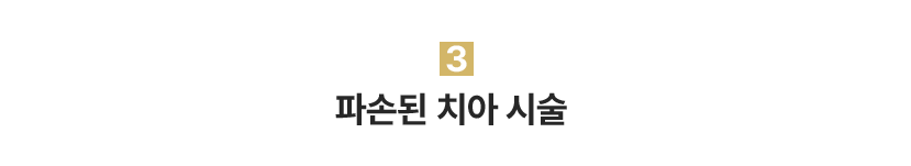 3.파손된 치아 시술