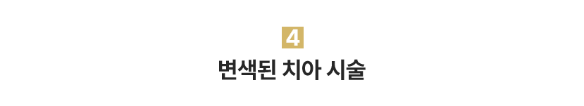 4.변색된 치아 시술