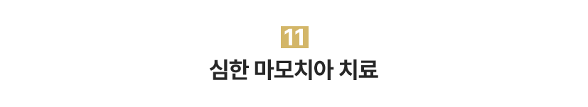 11.심한 마모치아 치료