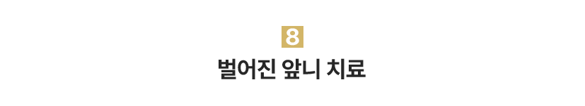 8.벌어진 앞니 치료