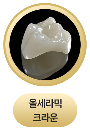 올세라믹 크라운