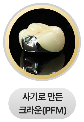 사기로 만든 크라운