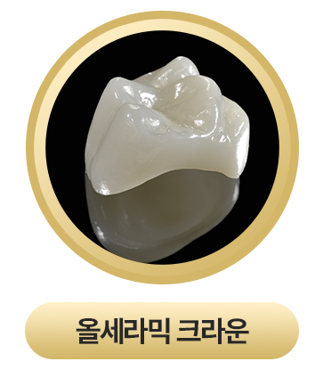 올세라믹 크라운