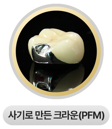 사기로 만든 크라운