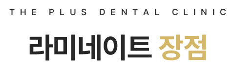 라미네이트 장점