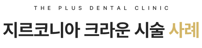 지르코니아 크라운 시술 사례