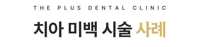 치아 미백 시술 사례