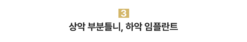 상악 부분틀니, 하악 임플란트