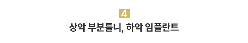 상악 부분틀니, 하악 임플란트