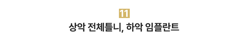 상악 전체틀니, 하악 임플란트