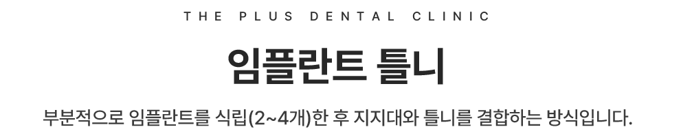 임플란트 틀니
