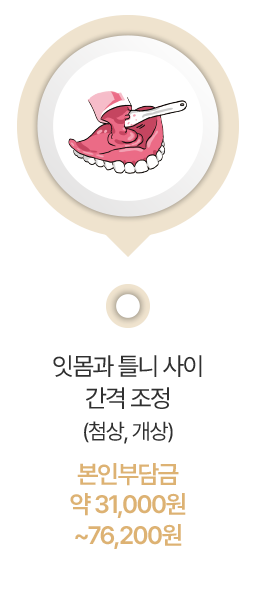 잇몸과 틀니 사이 간격 조정