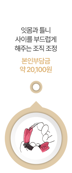 잇몸과 틀니 사이를 부드럽게 해주는 조직 조정