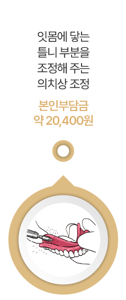 잇몸에 닿는 틀니 부분을 조정해 주는 의치상 조정