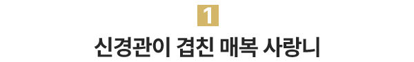 1.신경관이 겹친 매복 사랑니