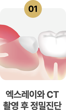 1.엑스레이와 CT촬영 후 정밀진단