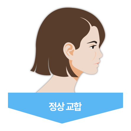 정상 교합