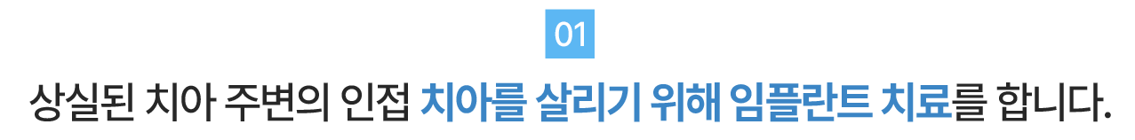 더플러스가 생각하는 임플란트 치료01