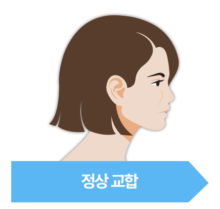 정상 교합