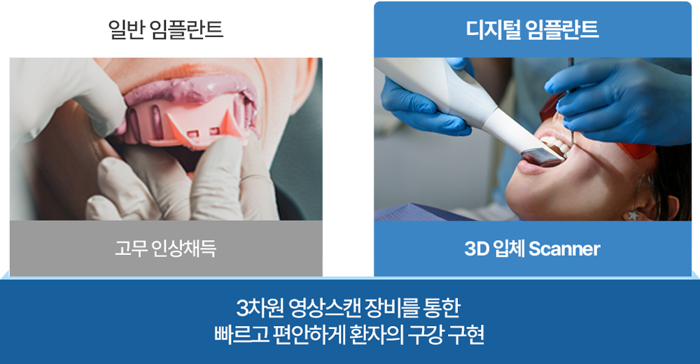 3차원 영상스캔 장비를 통한 구강 구현