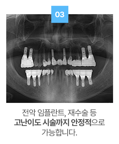 왜 더플러스를 추천하나요?