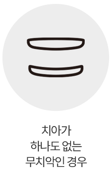 치아가 하나도 없는 무치악인 경우