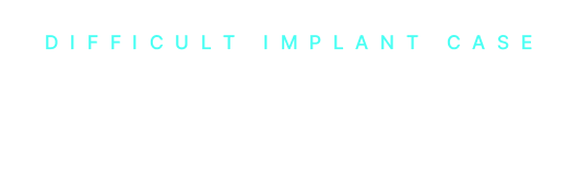 임플란트 시술 증례