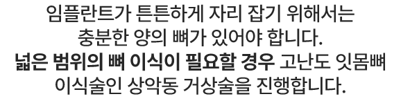 넓은 범위의 뼈 이식이 필요할 경우 고난도 잇몸뼈 이식술인 상악동 거상술을 진행합니다