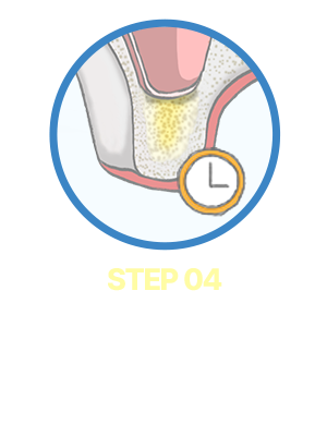 Step04. 재생기간 확보