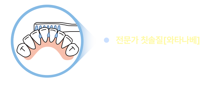 전문가 칫솔질 [와타나베]