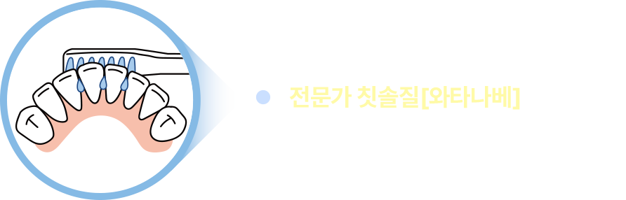 전문가 칫솔질 [와타나베]